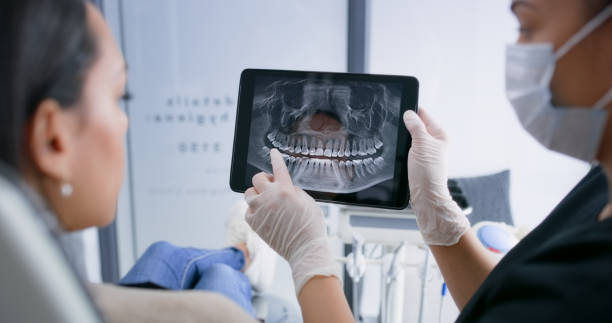 Licensed Tooth Extraction service in Union Point, GA - Smile Center Dentistry